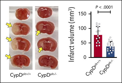 Mice without CypD in their platelets are protected from reperfusion injury following cerebral ischemia. See Figure 1A-B in the article by Denorme et al that begins on page 429.