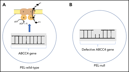 Panel A illustrates an intact ABCC4 gene encoding the plasma membrane ABC transporter. ATP is hydrolyzed providing the energy to remove substrates (black rectangle with irregular line). Panel B illustrates a defect in the ABCC4 gene characteristic of individuals lacking ABCC4 protein, a characteristic of the PEL-null blood group.