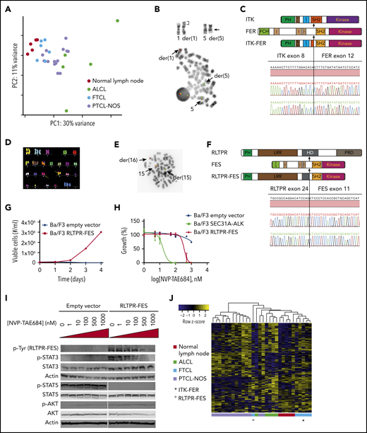 Genetic and functional analysis of the identified fusion genes. (A) Principal component (PC) analysis of gene counts for normal lymph nodes (n = 5), anaplastic large cell lymphoma (n = 5), FTCL (n = 6), and peripheral T-cell lymphoma not otherwise specified (n = 14) using our data and publically available data.23,24 (B) Partial karyotype illustrating inv(5)(q21q33) masked by t(1;5)(p34;q21) (breakpoints indicated by arrows) identified in patient 1 (upper panel) and metaphase FISH with a dual-color break-apart probe for FER (lower panel). (C) Schematic depiction and DNA sequence trace of the ITK-FER fusion. (D) Complex karyotype, including cryptic t(15;16)(q26;q22), identified by multicolor FISH in patient 2. (E) Metaphase FISH with a dual-color break-apart probe for FES performed in patient 2. (F) Schematic depiction and DNA sequence trace of the RLTPR-FES fusion. (G) Growth curve for Ba/F3 cells transduced with either empty vector or RLTPR-FES. (H) Relative proliferation of Ba/F3 cells transduced with empty vector, SEC31A-ALK, and RLTPR-FES in the presence of increasing concentrations of NVP-TAE684. (I) Western blot assessment of phosphorylated tyrosine residues (band at 131 kDa, corresponding to RLPTR-FES), STAT3 phosphorylation, STAT5 phosphorylation, and AKT phosphorylation in Ba/F3 cells transduced with empty vector or RLTPR-FES exposed to increasing concentrations of NVP-TA684. (J) Heat map representing the expression of STAT3 target genes in CD4+ T cells.