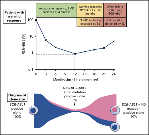 The top portion of the figure illustrates a hypothetical patient diagnosed with chronic phase CML and commenced on TKI therapy. The patient had a warning response to TKI, based on the 2013 European LeukemiaNet criteria due to of failure to achieve a major molecular response9 (BCR-ABL1 ≤0.1%) by 12 months. Although the patient’s response plateaued for several months, there was a subsequent progressive increase in BCR-ABL1 consistent with overt treatment failure. The lower portion of the figure illustrates the clone sizes at various stages of therapy. At the time of the warning response, a KD mutation emerged with an allele frequency of ∼3%, but because this was not detectable by SS, the same therapy was continued until the resistant clone expanded enough to be eventually detectable by SS. Earlier intervention would likely have prevented overt treatment failure by initiating an appropriate therapy switch when the new low-level KD mutation was detected.