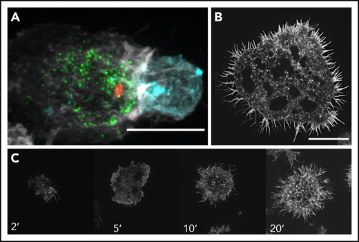 Examples of the NK cell IS during cytotoxicity. (A) Coincubation and subsequent fixed-cell imaging of NK cells (NK-92) conjugated to a K562 erythroleukemic target cell using spinning disk confocal microscopy. The image shows the formation of a lytic synapse between the NK and target cells where polymerized actin (white) is relatively enriched at the lytic immune synapse. The lytic granules (green; labeled using perforin as a marker for lytic granule content) are converged around the MTOC (red), with some having polarized toward the target cell (cyan; indicated with a membrane dye) as shown by the MTOC near the immune synapse. Image was cropped to focus on a single conjugate. (B) Structured illumination–total internal reflection fluorescence (SI-TIRF) microscopy of the actin meshwork at the IS of an NK cell (YTS) that was plated and fixed on an activating glass surface and then subsequently stained for F-actin using phalloidin. The activating surface is composed of anti-CD18 for adhesion and anti-CD28 for activation, thereby creating a representative target cell on a glass surface, enabling an en face assessment of actin architecture during IS formation. (C) Time lapse SI-TIRF microscopy of a YTS cell on an activated surface. YTS cells were placed on an activating glass surface and fixed at certain time points (2, 5, 10, and 20 minutes) and stained for F-actin using phalloidin to examine the evolution of the IS. The cell initially touches down upon the glass surface and initially extends out lamellipodia and filopodia as it spreads. By 20 minutes, a mature IS is formed as shown by the intricate dense actin mesh. Scale bars, 10 μm.