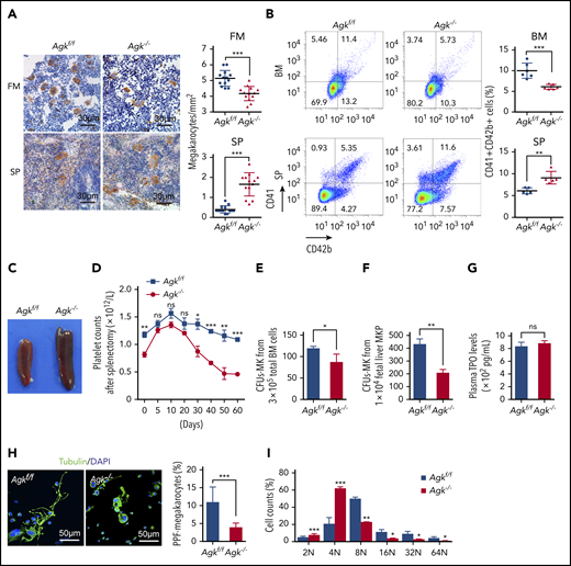 Impaired megakaryocyte development in Agkf/fPF4-Cre mice. (A) Immunohistochemical images of CD42c in femurs and spleens of Agkf/f mice and Agk−/− mice. The scale bars represent 30 μm. Statistics for the megakaryocytes in femur (FM) and spleen (SP) sections of Agkf/f mice and Agk−/− mice are shown (n = 13; ***P < .001). (B) CD41+CD42b+ megakaryocytes in BM and spleen samples were detected by flow cytometry. Statistics for the CD41+CD42b+ megakaryocytes in the BM (n = 6; ***P < .001) and spleen (n = 5; **P < .01) samples of Agkf/f mice and Agk−/− mice are shown. (C) Spleens of Agkf/f mice and Agk−/− mice. (D) Splenectomies were performed on Agkf/f mice and Agk−/− mice, and circulating platelet were counted at indicated time points (n = 5; *P < .05, **P < .01, ***P < .001). (E) Megakaryocyte colony-forming unit (MK-CFU) assay using BM cells harvested from Agkf/f mice and Agk−/− mice (n = 3; *P < .05). (F) Megakaryocyte colony-forming unit assay using sorted MKP cells from fetal liver of Agkf/f mice and Agk−/− mice (n = 3; **P < .01). (G) The level of TPO in the plasma from Agkf/f mice and Agk−/− mice (n = 6). (H) Immunofluorescence images of α-tubulin in PPF-megakaryocytes derived from the fetal livers of Agkf/f mice and Agk−/− mice. Scale bars, 50 μm. Statistics for the PPF-megakaryocytes/total megakaryocytes derived from the fetal livers of Agkf/f mice and Agk−/− mice are shown (n = 10; ***P < .001). (I) Percentage of megakaryocytes polyploidy derived from fetal liver of Agkf/f and Agk−/− mice (n = 3; *P < .05, **P < .01, ***P < .001). DAPI, 4′,6-diamidino-2-phenylindole; MK, megakaryocyte; MKP, megakaryocyte progenitor.