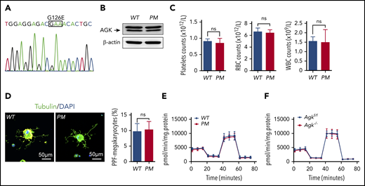 AGK regulates thrombocytopoiesis through a nonmitochondrial function. (A) Genotyping of AGK-G126E PM mice by sequencing. (B) The levels of AGK in the platelets of AGK-G126E PM mice were tested by western blot analysis. (C) Platelet, RBC, and WBC counts in WT and AGK-G126E PM mice (n = 4). (D) Immunofluorescence images of α-tubulin in PPF-megakaryocytes derived from the fetal livers of WT mice and AGK-G126E PM mice. The scale bars represent 50 μm. Statistics for the PPF-megakaryocytes/total megakaryocytes derived from the fetal livers of WT mice and AGK-G126E PM mice are shown (n = 10). (E) Extracellular flux analysis of the OCRs of the platelets of WT and PM mice; 2 μM oligomycin, 0.25 μM FCCP, and 1 μM rotenone/antimycin A were added at the indicated time points. The OCR was normalized to the protein amount (n = 6). (F) Extracellular flux analysis of the OCRs of the platelets of Agkf/f and Agk−/− mice; 2 μM oligomycin, 0.25 μM FCCP, and 1 μM rotenone/antimycin A were added at the indicated time points. The OCR was normalized to the protein amount (n = 4).