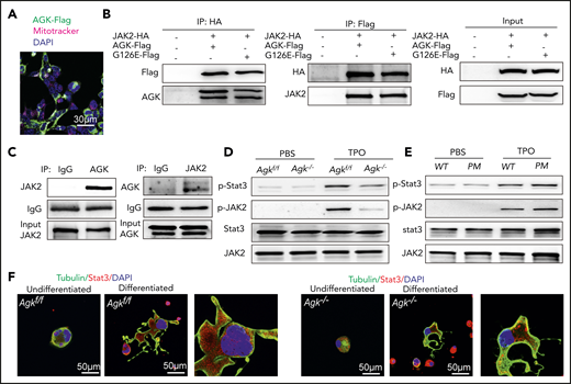 AGK facilitates the JAK2/Stat3 signaling pathway in platelets and megakaryocytes by binding to JAK2. (A) Immunofluorescence image of HEK293T cells transfected with AGK-Flag. HEK293T cells were stained with Flag antibodies (Alexa Fluor 488), DAPI, and a mitochondria-targeting dye (MitoTracker Deep Red). The scale bars represent 30 μm. (B) Coimmunoprecipitation of the lysates of HEK293T cells transfected with JAK2-HA and AGK-Flag/AGK-G126E-Flag using HA beads or Flag beads. (C) Immunoprecipitation of platelet lysates with anti-AGK or anti- JAK2 antibodies. (D) The JAK2 and Stat3 phosphorylation levels of WT and AGK-null platelets in response to 25 IU/mL TPO were tested by western blot analysis. (E) The JAK2 and Stat3 phosphorylation levels of the platelets of WT and AGK-G126E PM mice in response to 25 IU/mL TPO were tested by western blot analysis. (F) Immunofluorescence images of undifferentiated or differentiated megakaryocytes derived from the fetal livers of Agkf/f and Agk−/− mice. Megakaryocytes were stained with tubulin antibodies (Alexa Fluor 488), DAPI, and Stat3 antibodies (rhodamine). Scale bars, 50 μm. IgG, immunoglobulin G; IP, immunoprecipitation.