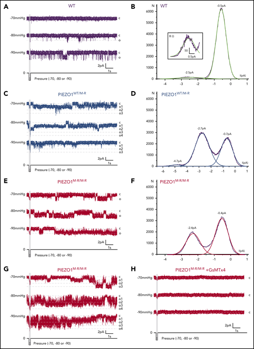 Failure of deactivation in PIEZO1WT/M-R and PIEZO1M-R/M-R single channels. Data are for single-channel activity measured by the cell-attached patch technique applied to freshly isolated RBCs of WT (A-B), PIEZO1WT/M-R (C-D), and PIEZO1M-R/M-R (E-H) mice. A fast pressure-clamp system applied brief (200 ms) negative pressure pulses to the patches, as indicated below the original exemplar current traces (A,C,E,G,H). Dashed horizontal lines indicate current levels for closed channels (c) and open channels (o, or o1-4 for multiple channel openings in panels C and G). Constant voltage of +80 mV was applied to the patch pipette. (A,E) Data are considered to be for patches each containing only 1 PIEZO1 channel; (C,G) patches contain multiple PIEZO1 channels. (B,D,F) Amplitude histogram analysis for the exemplar traces, showing plots of the frequency of detection of events (N) at the current amplitudes indicated on the x-axis, where zero current indicates no current flowing in the circuit. The closed channel state appears as a small negative current peaking at −0.5 (B), −0.7 (D), and −0.4 pA (F). (Bi) The small amount of open channel activity at −2.5 pA is shown in an expansion. Raw data are shown with superimposed Gaussian fits in green (WT), blue (PIEZO1WT/M-R), and red (PIEZO1M-R/M-R). Representative of n = 6, 5, and 4 for WT, PIEZO1WT/M-R, and PIEZO1M-R/M-R, respectively. (H) An exemplar recording from a PIEZO1M-R/M-R RBC patch with 2.5 μM GsMTx4 in the extracellular solution (n = 5).