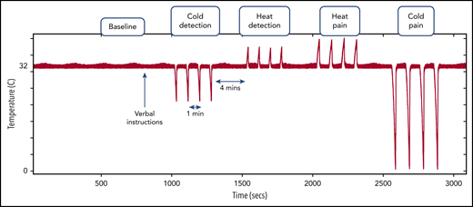 Thermal stimulus protocol showing the timing and order of the different thermal stimuli after a baseline recording period. Red signal with the pulses represents the thermode temperature, showing the pattern of thermal stimuli. During the verbal instructions, the participant was informed of upcoming thermal stimuli, but there was minimal interaction thereafter.