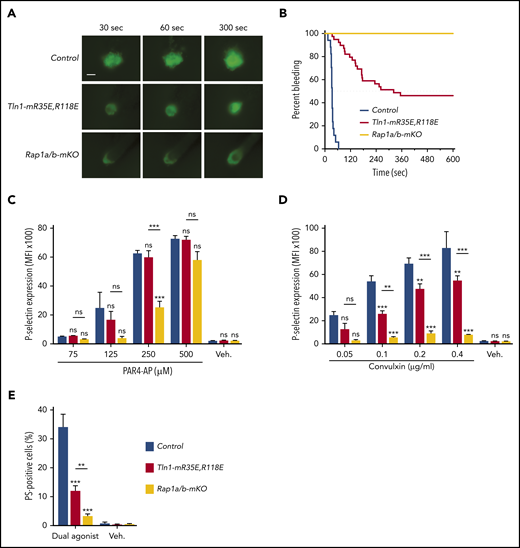 Tln1-mR35E,R118E mice exhibit milder defects in hemostasis compared with Rap1a/b-mKO mice, along with preserved capacity of platelets to secrete α-granules and expose surface PS. (A-B) Intravital microscopy studies to monitor hemostatic plug formation after laser injury to the saphenous vein in Tln1-mR35E,R118E and Rap1a/b-mKO mice. Before laser injury, animals were injected with Alexa Fluor 488–conjugated antibodies to GPIX to label circulating platelets and Alexa Fluor 647–conjugated antibodies to fibrin. The experiment was terminated at the end of 10 minutes to avoid excessive loss of blood. (A) Representative images taken 30, 60, and 300 seconds after laser injury. Scale bar, 50 μm. (B) Percentage of bleeding injury sites was plotted over time for each experimental group. Seventeen injury sites in 3 control mice, 39 injury sites in 5 Tln1-mR35E,R118E mice, and 8 injury sites in 2 Rap1a/b-mKO mice were tested. Statistical significance was assayed by using the Gehan-Breslow-Wilcoxon test with Bonferroni correction. (C-D) Comparisons of the 3 pairs of groups were all statistically significant using a family-wise significance level of 5%. Flow cytometry analysis of P-selectin (CD62P) surface expression onto GPIX-labeled platelets in whole blood in response to PAR4-AP (C) or convulxin (D) stimulation. Bar graphs represent Δ mean fluorescence intensity (MFI) ± standard error of the mean (n = 6 mice). Two-way analysis of variance with Tukey post-test. (E) Determination according to flow cytometry of PS exposure onto GPIX-labeled platelets in whole blood in response to dual stimulation with 100 ng/mL of convulxin and 500 μM of PAR4-AP. Bar graph represents the percent mean ± standard error of the mean (n = 6 mice). Two-way analysis of variance with Tukey posttest. **P < .01; ***P < .001. ns, not significant.