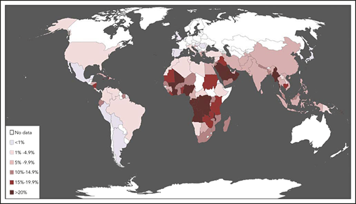 Epidemiology of G6PD deficiency. The map was constructed by compiling, from the world literature, data on the population frequency of polymorphic G6PD alleles that cause enzyme deficiency. Country-specific frequency ranges, full references, and additional details are given in supplemental Table 1, available on the Blood Web site. Although frequencies may vary widely within the same country, each country was assigned here a color based on the best estimate of the average frequency of G6PD deficiency, probably the most important figure from the point of view of public health. This map represents a thorough update of one first published in 1989 and widely reproduced.20 A similar map was published in 2009,21 and one based on a sophisticated geostatistical model in 2012.22