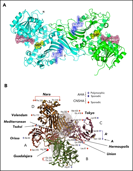 3-Dimensional structure of the human G6PD protein. Both the dimer and the tetramer are enzymatically active. The dimer/tetramer ratio within different cells or under different conditions is still not known, but it affects the pH-dependence of G6P binding.92 It is still not known what proportion of G6PD, within cells, is in dimer form. (A) The G6PD dimer, showing the binding sites of the 2 substrates G6P (yellow) and NADP (purple), and the site of the “structural” NADP (blue) (from Gómez-Manzo et al78). (B) The G6PD tetramer, showing the positions of a small selection of G6PD variants. Note (on top) the relatively large in-frame deletion of G6PD Nara: this is compatible with residual G6PD activity because the 8 aa involved are in a nonstructured region. Modified from Mason et al93 with permission.