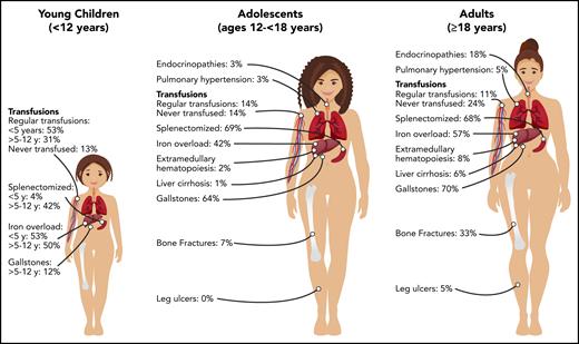 Burden of morbidities, management, and complications in young children (<12 years), adolescents (ages 12 to ≤18 years), and adults (≥18 years) with PKD.