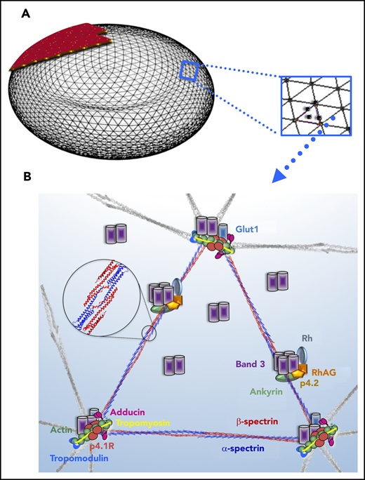RBC membrane model depicting the structural proteins that, when abnormal, cause RBC membrane disorders. (A) Model of the RBC cytoskeleton quasihexagonal lattice forming a biconcave disc shape, supporting the lipid bilayer. An area of the cytoskeleton surface is shown “magnified” to demonstrate the arrangement of proteins within the hexagonal structure, focusing particularly on the proteins that, when defective, cause RBC membrane disorders. Illustration by Anastasios Manganaris (created using “blender” software, version 2.8). (B) α- and β-spectrin heterodimers associate head to head, as shown in the magnified circle, to form the spectrin tetramers that make the sides of each triangular unit in the hexagon. Each dimer head is composed of the N-terminal region of α-spectrin and the C-terminal region of β-spectrin. The junctional complex, at the corner of each triangle, is formed by an actin oligomer, with a length guided by tropomyosin, and capped by adducin and tropomodulin. Protein 4.1R enables the actin-spectrin association. The transmembrane protein complexes containing the integral membrane proteins band 3 and Rh-associated glycoprotein (RhAG) and the peripheral membrane proteins ankyrin and band 4.2 provide “vertical” linkages between the cytoskeleton and the lipid bilayer.