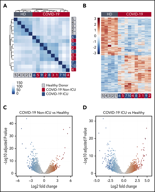 SARS-CoV-2 infection alters the platelet transcriptome. RNA-seq was performed on RNA isolated from highly purified platelets from 6 non-ICU and 4 ICU SARS-CoV-2 patients and 5 matched healthy donors (HD) as described in “Methods”. (A) Hierarchical clustering of samples according to global gene expression demonstrates non-ICU SARS-CoV-2–infected patients (red numbers) and ICU (blue numbers) cluster together whereas healthy donors (gray numbers) segregate together. (B) Heat map of significantly differentially expressed platelet transcripts from SARS-CoV-2–infected ICU and non-ICU patients and healthy control donors. Red indicates increased relative expression, and blue indicates decreased relative expression. Only coding mRNAs were examined in this analysis. (C-D) Volcano plot with significantly increased (red) and decreased (blue) transcripts from non-ICU and ICU COVID-19 patients.