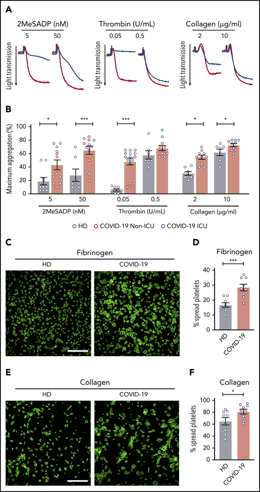 Platelets from COVID-19 patients are hyperreactive. Platelets were isolated from healthy donors and COVID-19 patients. (A) Representative aggregation traces of washed platelets from ICU COVID-19 patients or healthy donors treated with 2MeSADP (5 nM or 50 nM), thrombin (0.05 U/mL or 0.5 U/mL), or collagen (2 μg/mL or 10 μg/mL) under stirring conditions at 37°C. (B) Quantification of maximal aggregation (N = 7-10 for healthy donors; N = 10-15 for SARS-CoV-2–infected patients). Blue dots indicate ICU patients; red dots indicate non-ICU patients. (C) Washed platelets were allowed to spread on fibrinogen (scale bar, 50 μm; phalloidin stain). (D) After 30 minutes, platelets were fixed and platelet spreading was quantified. (E) Washed platelets were allowed to spread on collagen (scale bar, 50 μm; phalloidin stain). (F) After 30 minutes, platelets were fixed and platelet spreading was quantified. Images are representative for 9 independent experiments. Blue dots indicate ICU patients; red dots indicate non-ICU patients. *P < .05; **P < .01; ***P < .001.