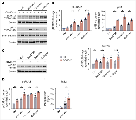 The MAPK-signaling pathway is upregulated in COVID-19 ICU patient platelets. (A) Washed platelets were stimulated with 2MeSADP (1 ng/mL), thrombin (0.05 U/mL), collagen (2 μg/mL), or vehicle under stirring conditions for 5 minutes. Platelet proteins were separated by sodium dodecyl sulfate polyacrylamide gel electrophoresis (SDS-PAGE), subsequent western blots were probed for phosphorylated extracellular signal-regulated kinase 1/2 (ERK1/2) (T202/Y204), phosphorylated p38 (T180/Y182), and phosphorylated eIF4E (Ser209). β-actin was used as loading control. (B) Quantification of phosphorylation normalized to β-actin (n = 4). (C) Washed platelets were stimulated with 2MeSADP (1 ng/mL), thrombin (0.05 U), collagen (2 μg/mL), or vehicle under stirring conditions for 5 minutes. Platelet proteins were separated by SDS-PAGE, subsequent western blots were probed for phosphorylated cytosolic phospholipase A2 (cPLA2) (Ser505). (D) Quantification of phosphorylation normalized to β-actin (n = 4). (E) Thromboxane B2 (TXB2) generation was measured as described in “Methods” (n = 8). *P < .05; **P < .01.