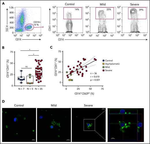 Increased platelet-monocyte aggregates in severe COVID-19 patients. (A) Gating strategy for analysis of platelet-monocyte aggregates in patients with COVID-19 or control subjects. (B) Percentage of platelet-monocyte complexes (CD14+CD41+) among monocytes from SARS-CoV-2− control volunteers, SARS-CoV-2+ asymptomatic subjects, or symptomatic patients presenting mild to severe COVID-19 syndrome. The horizontal lines in the box plots represent the median, the box edges represent the interquartile ranges, and the whiskers indicate the minimal and maximal value in each group. *P < .05 between selected groups. (C) The percentage of platelet P-selectin (CD62P) surface expression was plotted against the percentage of platelet-monocyte complexes in the same infected subjects. Linear regression and Pearson correlation were calculated according to the distribution of the dots. (D) Phalloidin-labeled cytospin blood samples from control subjects or COVID-19 patients. Platelets and leukocytes obtained from whole blood after lysis of erythrocytes were labeled with Alexa 488–phalloidin (F actin, green) and DAPI (nuclei, blue). Scale bar, 10 μm; inset, 5 μm. Representative images of platelet-monocyte aggregates are shown. The fourth panel shows orthogonal views from different planes of the confocal image. The green line generated a 2-dimensional (2D) image that is shown in the top green rectangle whereas the red line–generated 2D image is shown in the red rectangle on the right. SSC-H, side scatter height.