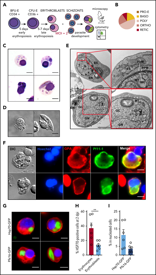 Immature gametocytes develop properly within human primary erythroblasts. (A) Diagram illustrating the erythroblast infection protocol. Burst forming unit-erythroid cells (BFU-E) expressing CD34 were cultivated for 7 days to generate colony forming unit-erythroid cells (CFU-E) expressing CD36 and then CFU-E were allowed to differentiate into late erythroblasts for 5 to 7 days. Synchronized GFP-expressing schizonts at 40 hpi were added to erythroblasts at an MOI of 2. After several days of culture, infected erythroblasts were analyzed by fluorescent microscopy and flow cytometry. (B) Distribution of the different erythroblast stages at the time of infection. Morphological analysis of erythroblasts was performed by May-Grünwald Giemsa staining of cytospin from 3 independent experiments. (C) Erythroblast infection was observed by May-Grünwald Giemsa staining at 1 dpi (ring stage, upper left panel), 2 dpi (trophozoite stage, upper right panel and schizont stage, lower left panel), and 6 dpi (stage III gametocyte, lower right panel). Scale bars, 5 μm. (D) Gametocytes within erythroblasts at 6 dpi were observed by differential interference contrast microscopy: stage III gametocyte (left panel) and stage IV gametocyte (right panel). Scale bars, 5 μm. (E) Transmission electron microscopy shows that immature gametocytes within infected erythroblasts present typical sexual structures as the microtubular network (MT) and the inner membrane complex (IMC). Scale bars, 1 µm (left panels); 200 nm (right panels). (F) Immunofluorescence analysis of paraformaldehyde-fixed gametocyte-infected erythroblast at 6 dpi stained with anti–Pf11-1 antibodies (green) and with anti-GPA labeling the erythroblast membrane (red). DNA is stained with Hoechst 33342 (blue). Scale bars, 5 μm. (G) Infection with the Hsp70-GFP line (upper panels) and with the Pfs16-GFP line (lower panels) was observed by fluorescent microscopy at 2 dpi (upper panels and lower left panel) and at 6 dpi (lower right panel). Erythroblast membrane is stained with PKH-26 (red). DNA is stained with Hoechst 33342 (blue). Scale bars, 5 μm. (H) Infection of erythrocytes or erythroblasts with the Hsp70-GFP line was evaluated by flow cytometry at 2 dpi. (I) Infection of erythroblasts with the Hsp70-GFP and Pfs16-GFP lines was evaluated by flow cytometry at 2 dpi. (H-I) Circles indicate the number of independent experiments (n = 6) that were performed on erythroblasts derived from cytaphereses (n = 5) or bone marrow aspirates (n = 1) from 4 independent donors. Error bars show the standard error of the mean. **P < .01. BASO, basophilic stage; DIC, differential interference contrast; EC, erythroblast cytosol; EN, erythroblast nucleus; ES, exomembrane system; GC, gametocyte cytosol; GN, gametocyte nucleus; ORTHO, orthochromatic stage; POLY, polychromatic stage; PPM, parasite plasma membrane; PRO-E, proerythroblast stage; PVM: parasitophorous vacuole membrane; RETIC, reticulocyte stage.