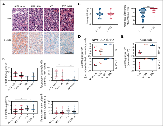 IL10RA is expressed in ALCL in an NPM1-ALK–independent manner. (A) Representative hematoxylin and eosin (H&E) staining with corresponding IL-10RA immunohistochemistry staining performed on TMAs from different human T-cell lymphoma subtypes: ALK+ and ALK− ALCL, AITL, and PTCL-NOS. (B) Intensity of staining (left panels) or percentage of tumor cells expressing IL-10RA (upper right panel) or IL-10RB (lower right panel), as determined by immunohistochemistry of a TMA of formalin-fixed paraffin-embedded (FFPE) T-cell lymphoma patient samples: ALK+ ALCL, n = 25; ALK− ALCL, n = 25; AITL, n = 7; PTCL-NOS, n = 21. Data are means ± standard deviation (SD). (C) Intensity of staining (left panel) or percentage of tumor cells expressing IL-10RA (n = 92) or IL-10RB (n = 89) (right panel), as determined by immunohistochemistry of a TMA of FFPE pediatric ALK+ ALCL patient samples. Data are presented as a violin plot with the means indicated. (D) Fold change in IL-10, IL-10RA, and IL-10RB mRNA expression levels in the indicated ALCL cell lines transduced with a doxycycline-dependent ALK shRNA. Doxycycline-induced cells were compared with noninduced cells and were normalized to glyceraldehyde-3-phosphate dehydrogenase (GAPDH). Data are means ± SD (n = 3). (E) Fold change in IL-10, IL-10RA, and IL-10RB mRNA expression levels in crizotinib-treated (300 nM for 6 hours) ALCL cell lines normalized to GAPDH and relative DMSO control. Data are means ± SD (n = 3). *P < .05. **P < .01, ***P < .001, Welch 2-sample t test.
