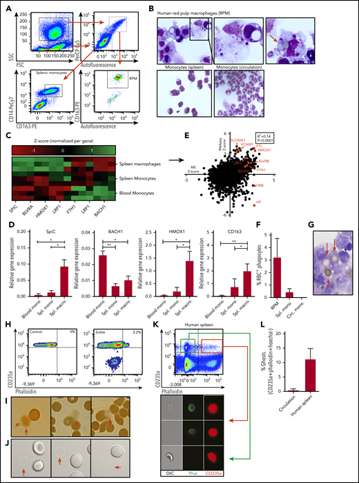 Characterization of human RPMs and erythrocyte turnover. (A) Flow cytometry gating strategy used to isolate human spleen RPMs and splenic monocytes. Forward scatter and side scatter (SSC) were used to differentiate between monocyte and macrophage-containing populations of cells. From the granulocyte and macrophage-containing gate (left upper panel), the autofluorescent (AF) cells were selected (right upper panel) which were further subdivided into CD163-expressing and -nonexpressing cells (lower right panel). The CD163+AF+ cells are the RPMs. From the lower forward scatter and side scatter gate, the monocytes were isolated on the basis of CD14 and CD163 expression (lower left panel). (B) Representative cytospin micrograph of flow cytometry-sorted spleen-derived RPMs, splenic monocytes, and circulatory monocytes. (C) Z scores of genes related to iron recycling obtained by RNA sequencing (RNA-seq) on RPMs, splenic monocytes, and circulatory monocytes (n = 3). (D) Quantitative polymerase chain reaction was performed to verify RNA-seq data. Gene expression is normalized to the GAPDH housekeeping gene and expressed as relative gene expression (n = 3, mean ± SD). In line with the increased SpiC expression in RPMs, BACH1, the repressor of SpiC, was found to be downregulated. (E) Correlation between relative protein expression as determined by mass spectrometry (MS) (n = 5) and transcript abundance as determined by RNA-seq (n = 3) by RPMs. Several genes of interest are shown in red. (F) Quantification of the percentage of RPMs with ≥1 erythrocyte inclusions as depicted in Figure 1B (n = 3-6). (G) Representative benzidine staining of human RPMs depicting relatively intact adhering and internalized erythrocytes. (H) Ghost erythrocytes were detected by F-actin staining (phalloidin) in combination with antiglycophorin-A staining for the erythroid-specific marker (antiCD235a). (I-J) Conventional light microscope micrograph and benzidine staining depicting erythrocytes and erythrocyte ghosts (red arrows). (K-L) Flow cytometric gating strategy used to quantify ghost erythrocytes in the circulation of healthy individuals and in human spleen tissue. White lines mark border cropping of the image because the output file was too large. *P < .05; **P < .01 (mean ± SD). Circ, circulating; macro, macrophage; mono, monocyte; ns, not significant; Spl., spleen.