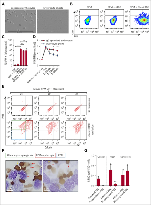 RPMs recognize and degrade erythrocyte ghosts in vivo and in vitro. (A) Micrograph of dense erythrocytes from healthy volunteers by density centrifugation (senescent erythrocytes, left panel) and in vitro generation of ghost erythrocytes (right panel). (B-C) Senescent erythrocytes (sRBCs) and ghost erythrocytes (ghost RBCs) were stained with PKH and coincubated with a single-cell suspension of human spleen cells for 45 minutes at 37°C, were vigorously washed, and their interaction with RPMs (CD163+Hoechst+AF+CD14− subpopulation) was quantified by flow cytometry. (D) Erythrocyte and ghost breakdown rates by RPMs were quantified by measuring mean fluorescence intensity (MFI) of PKH during a time course of 60 minutes. (E) Mice received either a transfusion of PKH- and calcein-labeled senescent erythrocytes (bottom row, red quadrant) or vehicle (top row). RPMs were gated on the basis of autofluorescence and Hoechst staining. (F-G) F4/80+ MACS-isolated cells from mice that received no transfusion, a fresh transfusion, or a transfusion of senescent erythrocytes were MACS isolated and subjected to benzidine staining. Attached and phagocytosed erythrocytes were quantified. Red arrows indicate phagocytosed erythrocytes and ghosts and yellow arrows indicate intact erythrocytes. Phagocytosed erythrocytes and erythrocyte ghosts (red arrows) were observed only upon transfusion of senescent erythrocytes. *P < .05; **P < .01; ***P < .001; ****P < .0001. Error bars indicate SD unless stated otherwise.