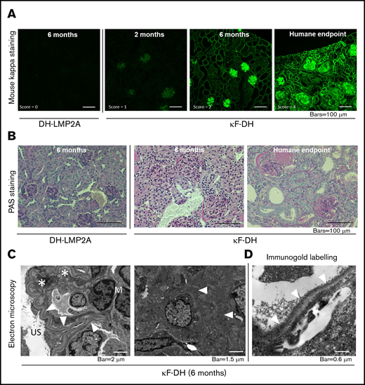 Kidney section analysis of κF-DH mice. (A) Immunofluorescence microscopy on frozen kidney sections of κF-DH mice using anti-mouse κ antibody at 2 and 6 months and humane end point, compared with DH control mice. κLC deposits in κF-DH mice are detectable as soon as age 2 months and become intense with age along tubular and glomerular BMs and in the mesangium. Lesion scores are indicated (see "Methods"). Original magnification ×200. (B) Periodic acid Schiff (PAS) staining performed on paraffin-embedded kidney sections showing tubular BMs thickening and nodular glomerulosclerosis with mesangial expansion of the ECM and mesangial cell proliferation. Note the massive enlargement of glomeruli in κF-DH mice. Original magnification ×200. (C) Electron microscopic analysis showing in left panel linear electron-dense deposits in the inner aspect of the glomerular BM (arrowhead). Subendothelial space is extremely widened, consistent with thrombotic microangiopathy–like lesions (asterisk). Original magnification ×8000. Right panel shows granular electron-dense deposits in the mesangium (arrowhead). Original magnification ×10 000. (D) Immunoelectron microscopy (original magnification ×40 000). Presence of anti-κ gold-conjugated particles along the inner aspect of glomerular BM (arrowhead). All data are representative of at least 3 kidneys in each group.