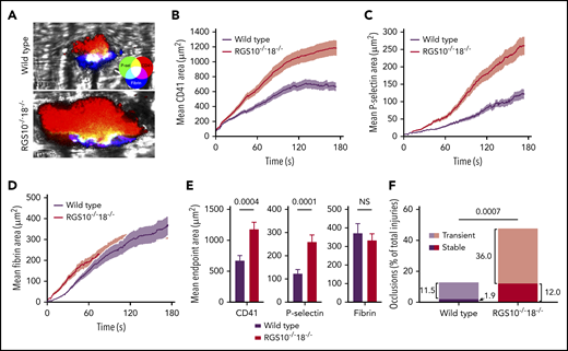Hemostatic response to injury. Real-time confocal intravital microscopy following penetrating laser injuries in cremaster muscle arterioles in WT and RGS10−/−18−/− mice. (A) Representative end-point images of hemostatic plugs. Mean area of accumulation over time was measured for CD41 (αIIb integrin) (B), P-selectin (C), and fibrin (D). (E) Mean end-point area calculations. (F) The fraction of injuries that produced stable or transient occlusions. n = 52 injuries in 3 WT mice; n = 50 injuries in 4 RGS10−/−18−/− mice; mean ± SEM.
