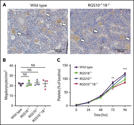 Megakaryocytes and platelet production. (A) Cross-sectioned femurs harvested from WT, RGS18−/−, RGS10−/−, and RGS10−/−18−/− mice were stained for CD41 (αIIb integrin) and counterstained with hematoxylin. Large, multinucleate CD41+ cells were counted as megakaryocytes. White arrows point to representative examples. (B) Megakaryocyte counts from 5 randomly selected fields per mouse. n = 3; mean ± SEM. (C) Platelet depletion with an anti-GPIbα antibody followed by recovery over the course of 96 hours represented as a percentage of the baseline for each genotype. **P ≤ .05 for WT vs RGS18−/− and RGS10−/−18−/−. n = 6; mean ± SEM.
