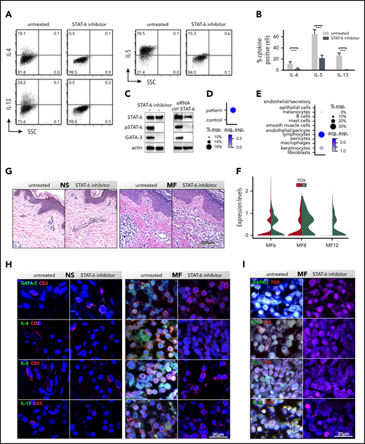 STAT6 inhibition impairs cytokine production by CD3+ MF and SS lymphocytes. SS peripheral blood CD4+ T cells were activated in vitro with CD3/CD28, treated with/without STAT6 inhibitor (AS1517499) for 5 days, and restimulated with PMA and ionomycin. The proportion of IL-4+, IL-5+, and IL-13+ cells was determined by intracellular cytokine staining. (A-B) Representative examples (A) and cytokine frequency (B) shown from multiple SS patients (n = 5, P = .002: Student t test). Mean percentage of positive cells ± standard deviation is shown. (C) Cellular lysates were obtained at day +5 from blood SS CD4+ T cells treated with/without AS1517499 (n = 5) or transfected with STAT6 or target control (crtl) siRNAs (n = 3). Immunoblots were performed with STAT6, phospho (p)STAT6, and GATA-3 antibodies. Actin was used as loading ctrl. (D-E) A representative example is shown. ScRNAseq from fresh MF skin tumors (n = 3; supplemental Figure 4): dot-plots showing the proportion of cells and the scaled average GATA-3 gene expression between MF and NS samples (D)  and by different cell types (E). (F) Violin plots show expression of GATA-3 by TOX+ and TOX− lymphocytes from MF tumors. Ex vivo skin explants from the excised MF skin tumors and NS were cultured for 5 days with/without STAT6 inhibition. (G) Hematoxylin and eosin staining, (×200) from representative examples are shown. (H-I) Double-color immunofluorescence staining for Th2 cytokines and CD3 or Th2 cytokines (H) and TOX (I), as indicated (×1000). 4′,6-diamidino-2-phenylindole stains nuclei. Representative NS and MF skin explants out of 5 tumors and 5 controls tested are shown.