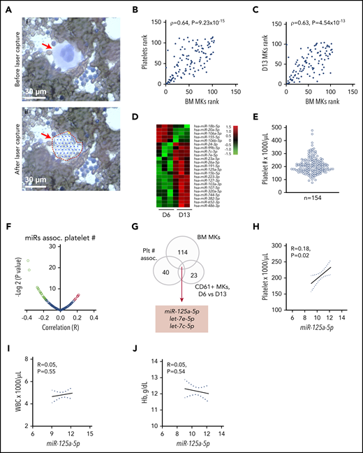 RNA profiling identifies miR-125a-5p association with platelet count. (A) Wright-Giemsa stain of BM aspirate. Scale bar, 30 μm. Same field (i) before and (ii) after laser-capture microdissection (LCM). Red arrow indicates mature MK. (B) Plot of Spearman rank correlation (ρ) of miRs from platelets and LCM BM MKs isolated from the same healthy donors (n = 2). (C) Plot of Spearman rank correlation (ρ) of miRs from CD61-purified, day 13–cultured, cord blood (CB)-derived MKs (n = 3 independent cords) and LCM BM MKs (n = 2 healthy donors). (D) Heat map shows miRs differentially expressed between day 6 (D6) and day 13 (D13) cultured cord blood–derived MKs (n = 3). (E) Variation in platelet count in 154 healthy donors. (F) Volcano plot shows platelet miR association with human platelet count. Green dots indicate negative correlation and red dots shows positive correlation of platelet miRs with platelet count in healthy donors; P < .05. (G) Venn diagram showing intersection of candidate miRs from panels A through F. (H-J) Plots of Pearson correlations (R) of (H) platelet count, (I) WBC, and (J) Hb level against miR-125a-5p levels (n = 154 healthy donors). Dotted lines, 95% confidence intervals. Plt # assoc., platelet number association.