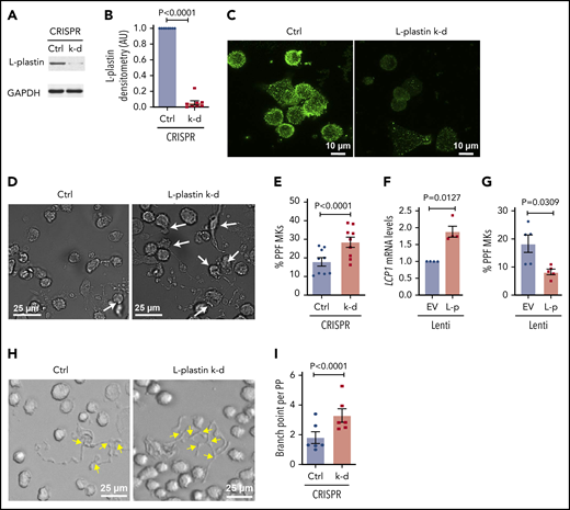 L-plastin regulates MK PPF and branching. (A) Representative immunoblot of L-plastin after CRISPR-Cas9 knockdown (k-d) in day 10 human CD34+-derived cultured MKs. Guide RNAs not targeting known genes are used as negative control (Ctrl). (B) Fold changes of MK L-plastin knockdown assessed by densitometry (n = 8). (C) Ctrl and CRISPR L-plastin k-d MKs on day 14 were stained with anti–L-plastin antibody (green) and imaged using a confocal microscope (60× objective). Scale bar, 10 μm. Staining for both Ctrl and k-d was performed under identical conditions and fluorescence acquisition for both images was obtained with identical microscope settings. (D) Representative brightfield images of cultured PPF MKs (white arrows) after L-plastin knockdown. Scale bar, 25 μm. (E) The percentage of MKs with PPs, scored blinded, after L-plastin knockdown (n = 9). (F) Fold changes of LCP1 expression assessed by real-time qPCR after L-plastin (L-p Lenti) or empty vector (EV Lenti) lentiviral overexpression (n = 4). (G) The percentage of MKs with PPs after L-plastin overexpression scored blinded as to the treatment group (n = 5). (E,G) At least 100 MKs per condition per cord were analyzed. (H) Brightfield image shows MK PP branches (yellow arrows) after L-plastin knockdown. Scale bar, 25 μm. (I) Quantification of MK PP branching, blinded to the treatment groups. At least 30 MKs per condition per cord were analyzed for n = 6 independent cultures.