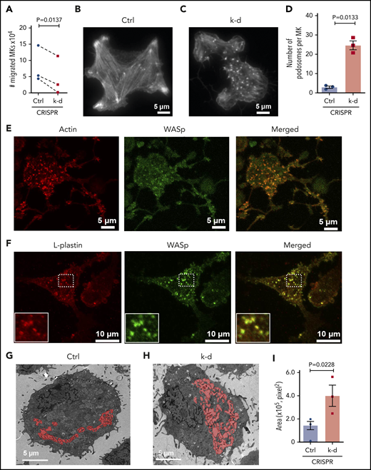 L-plastin regulates MK migration, podosome formation, and IMS. (A) MK migration in transwells toward the SDF-1α chemoattractant on day 13. CD41a+CD42a+ MKs quantified by flow cytometry and normalized to no SDF-1α (n = 3). (B-C) Representative F-actin staining of spread MKs on day 11 by total internal reflection fluorescence (TIRF) microscopy for (B) control MKs and (C) MKs with L-plastin knockdown. (D) Quantification of MK podosomes per MK without or with L-plastin knockdown on day 11 by TIRF (n = 3). At least 25 MKs per condition per cord were analyzed. (E) Representative image of day 14 cultured MKs were stained for actin using ActinRed 555 ready probes (shown in red) and Wiskott-Aldrich syndrome protein (WASp) using anti-WASP antibody Alexa Fluor 488 (shown in green). Scale bar, 5 μm. (F) Representative image of day 14 cultured MKs on fibrinogen were stained for L-plastin using anti-L-plastin primary antibody and Alexa Fluor 555 seconday antibody (shown in red) and WASp stained with anti-WASP primary antibody and Alexa Fluor 488 seconday antibody (shown in green). White box shows magnified image. Scale bar, 10 μm. (G-H) Representative transmission electron microscopic images showing MK IMS (red) without (G) or with (H) L-plastin knockdown. Scale bar, 5 μm. (I) Quantification of MK IMS without or with L-plastin knockdown. IMS is filled with red color using binary editor function of Nikon NIS-Element software (n = 3). At least 15 MKs per condition per cord were analyzed.