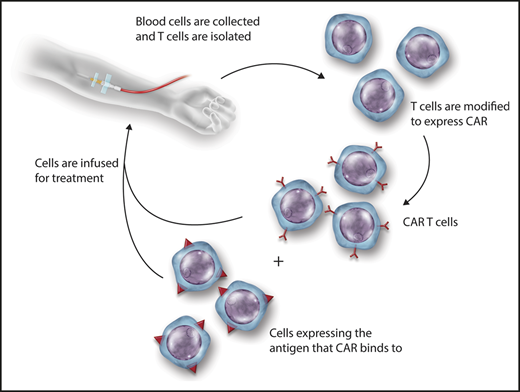 Providing antigen-expressing cells to CAR T cells may improve CAR T-cell engraftment. CAR T-cell immunotherapy involves transducing T cells with a CAR that enables T cells to specifically target and kill cells expressing a particular antigen. In situations in which antigen is in low abundance (such as HIV infection in which antigen is suppressed by antiviral drug therapy), CAR T cells can be helped by infusing cells that express the antigen for which the CAR is specific, that is, HIV Env. Professional illustration by Somersault18:24.