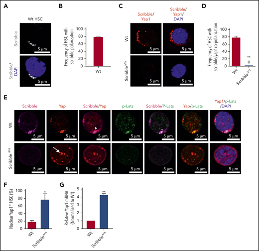 Scribble scaffolds components of the Hippo pathway in HSC and controls Yap1 cytoplasmic localization. (A) Immunofluorescence depicting Scribble protein localization in Wt HSC (immunophenotypically defined as LSK CD150+ CD48−) (white areas). Cells are counterstained with DAPI and merged images are shown in the bottom micrographs. Scale bar is 5 µm. (B) Quantification for the frequency of HSC with Scribble polarization. (C) Immunofluorescence depicting a proximity ligation assay (PLA) on Wt and ScribbleΔ/Δ HSC using anti-Scribble and anti-Yap1 primary antibodies subsequently targeted with corresponding probes for oligomerization. The detected dimers are pseudo-colored in red. Nuclei are counterstained with DAPI and merged images are shown in the right micrographs. Scale bar is 5 µm. (D) Quantification of PLA signal. (E) Immunofluorescence showing Scribble polarization and Yap1 colocalization (white arrowheads) in HSC isolated from Wt mice. White asterisks indicate areas of colocalization between Scribble and the activated upstream inhibitory kinase of Yap1, phosphorylated Lats1/2. White arrows denote Yap1 nuclear translocation in ScribbleΔ/Δ HSC. Nuclei are counterstained with DAPI; merged images are shown in the right micrographs. Scale bar is 5 µm. (F) Quantification for the frequency of HSC with Yap1 nuclear foci. (G) Quantitative reverse transcriptase polymerase chain reaction of Yap1 messenger RNA expression from HSC cultured for 40 hours; *P < .05; **P < .01.