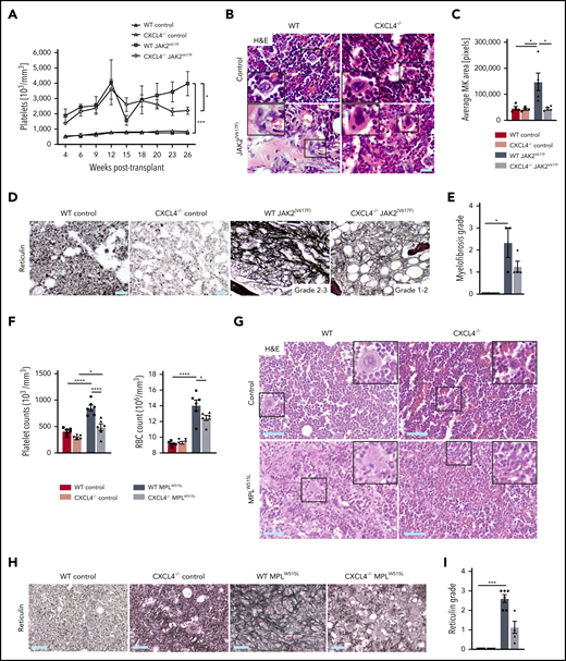 CXCL4 knockdown reduces thrombocytosis and fibrosis grade in JAK2(V617F) and MPLW515L murine models of PMF. C57BL/6 recipient mice received lethal irradiation at 10 weeks of age followed by either WT or Cxcl4−/− HSPCs transduced with JAK2(V617F), MPLW515L, or WT control retroviral vectors (n = 5 per group for JAK2(V617F) experiment; n = 6 per group for MPLW515L experiment). Mice were euthanized at 182 days after transplantation for the JAK2(V617F) experiment and 21 days’ posttransplantation for the MPLW515L experiment. (A) Platelet counts from peripheral blood. (B) Representative images of hematoxylin and eosin (H&E) staining in femurs. Original magnification ×20; scale bar, 100 μm. (C) Quantification of the mean area of MKs in control or JAK2(V617F)-driven BM. (D) Representative images of reticulin staining in control or JAK2(V617F)-driven BM. Original magnification ×20; scale bar, 100 μm. (E) Quantification of myelofibrosis grade based on reticulin staining in control or JAK2(V617F)-mutated BM (Kruskal-Wallis multiple comparisons test). (F) Platelet and red blood cell (RBC) counts in peripheral blood. (G) Representative images of H&E staining in femurs. Original magnification ×20; scale bar, 100 μm.(H) Representative images of reticulin staining in femurs. Original magnification ×20; scale bar, 100 μm. (I) Quantification of myelofibrosis grade based on reticulin staining in control or MPLW515L-mutated BM (Kruskal-Wallis multiple comparisons test). Data are shown as mean ± standard error of the mean, 1-way analysis of variance followed by Tukey’s post hoc test unless otherwise indicated. *P < .05, ***P < .001, ****P < .0001.