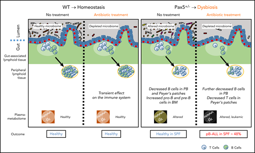 In the absence of natural infection, pB-ALL development can be triggered by cooperation between a genetic predisposition and microbiome changes. Left panel: in WT mice, a short-term depletion of bacteria in the gut microbiome using antibiotic treatment led to a transient effect on the immune system (including the gut-associated and peripheral lymphoid tissues). In this scenario, mice do not develop pB-ALL. Right panel: the Pax5 mutation altered the microbiome composition and affected B-cell maturation. The dysbiosis translated into an altered plasma metabolome. In the absence of a natural infectious environment, untreated Pax5+/– mice did not develop leukemia. However, in response to a transient depletion of the bacteria in the microbiome at age 8 weeks, pB-ALL was induced in 48% of the mice between age 11 and 21 months. Leukemia development was preceded by more prominent effects on the immune system13 and was associated with an altered plasma metabolome.