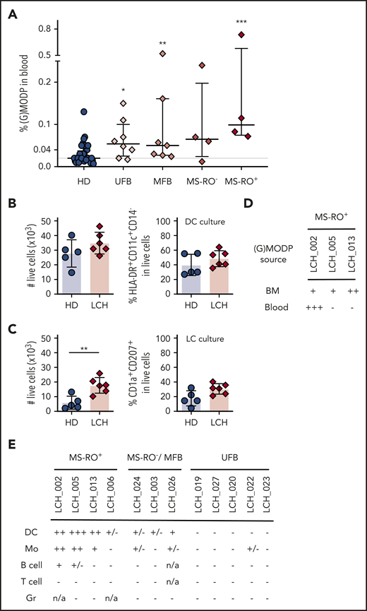 Blood GMODP frequency is elevated in low-risk LCH patients and their myeloid cells contain the BRAF mutation. (A) The frequencies (%) of (G)MODP in blood from unifocal bone (UFB), multifocal bone (MFB), MS-RO−, and MS-RO+ LCH patients and age-matched HD. See supplemental Table 1 for clinical details of the patients. Error bars indicate median and interquartile range; P values according to statistical testing by Mann-Whitney U test (*P < .05; **P < .01, ***P < .001). (B-C) (G)MODP cells were sorted from blood, cultured under DC (B) or LC (C) differentiation, and counted and analyzed for cell-surface phenotype by flow cytometry. Live-cell yield from 500 (G)MODP and the frequencies (%) of DC (HLA-DR+CD11c+CD14−) or LC-like cells (HLA-DR+CD11c+CD1a+CD207+) among live (G)MODP-derived offspring cells are represented for HDs (n = 5) and patients LCH_002, 005, 006, 013 (MS-RO+), 014 (MFB), and 019 (UFB) (n = 6) (supplemental Table 1). P values according to statistical testing by Mann-Whitney U test (**P < .01). (D) GMODP from BM and blood of the indicated BRAFV600E genotyped high-risk MS-RO+ LCH patients were seeded at 1500 to 2000 cells per well and cultured under DC-differentiation conditions, and the BRAF mutation was assessed by ddPCR in offspring cells. (E) BRAF mutation status of DCs, Mo’s, B cells, T cells, and granulocytes (Gr) from indicated LCH patients (supplemental Table 1).