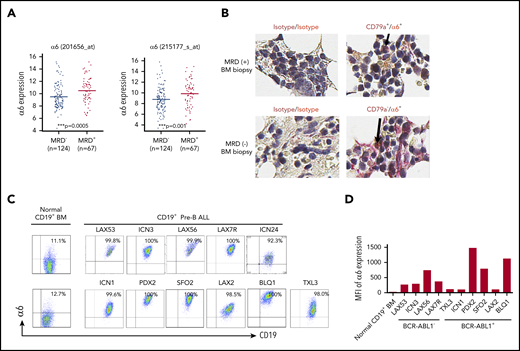 Integrin α6 is highly expressed in primary B-ALL. (A) Two probe sets for integrin α6 (ITGA6) in patients with MRD+ and MRD– ALL from COG study P9906 were analyzed. MRD was measured by flow cytometry at the end of induction therapy (day 29) using patients’ BM or PB samples. RNA was purified from 191 pretreatment diagnostic samples with more than 80% blasts (131 BM; 76 PB). The horizontal bars indicate the average levels of integrin α6 expression. P values were obtained by using the Wilcoxon test for each probe set. ***P = .0005 for probe 201656_at; ***P = .001 for probe 215177_s_at. (B) Immunohistochemical staining of isotype controls (left panel) or CD79a (brown) and α6 (red) expression (right panel) in MRD+ and MRD– biopsy specimens. Original magnification, ×630. (C) Representative dot plots of cell-surface α6 expression in B-ALL and normal BM CD19+ B-cell samples. One of 3 experiments is shown. (D) Representative mean fluorescence intensity (MFI) of α6 expression in CD19+ B-ALL and normal BM CD19+ B cells. One of 3 experiments is shown.