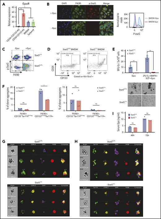 Differentiation of SEPs requires activation of macrophages through Epo-dependent Stat5 activation. (A) mRNA expression of EpoR in sorted SEPs (CD34+CD133+KS and CD34–CD133–KS), BMDMs, and sorted primary F4/80+ spleen macrophages (spleen ϕ). (B) Immunocytochemistry analysis of colocalization of phosphorylated Stat5, F4/80, and 4′,6-diamidino-2-phenylindole (DAPI) in BMDMs (left). Flow cytometry analysis of phosphorylated Stat5 in BMDMs with or without Epo (right). (C) Flow cytometry analysis of Stat5 phosphorylation in F4/80+ spleen macrophages isolated from Stat5fx/fx or Stat5Δ/Δ mice with or without Epo. (D) Flow cytometry analysis of CD34+CD133+KS SEPs cocultured with Stat5fx/fx BMDMs or Stat5Δ/Δ BMDMs. CD34 and CD133 expression is shown on cells gated on Kit+Sca1+. (E) Stress BFU-E colony number (top) and representative BFU-E morphology (bottom) of SEPs cocultured with Stat5fx/fx BMDMs or Stat5Δ/Δ BMDMs. (F) Quantification of flow cytometry analysis of early-stage F4/80+CD133+Ter119lo/neg EBIs and late-stage F4/80+CD133lo/negTer119+ EBIs after 48 hours of phenylhydrazine (PHZ) treatment (left) and 72 hours of PHZ treatment (right). F4/80, CD133, and Ter119 expressions are shown on aggregates gated on CD45.2+ (donor). (G-H) Representative FlowSight analysis of EBIs after (G) 48 hours of PHZ treatment and (H) 72 hours of PHZ treatment (n = 2-3 mice per group). (I) Serum Epo level measurement by enzyme-linked immunosorbent assay (ELISA) after PHZ treatment. Student t test (2-tailed). Data represent means ± standard error of the mean (SEM). ns, not significant. *P < .05; **P < .01.