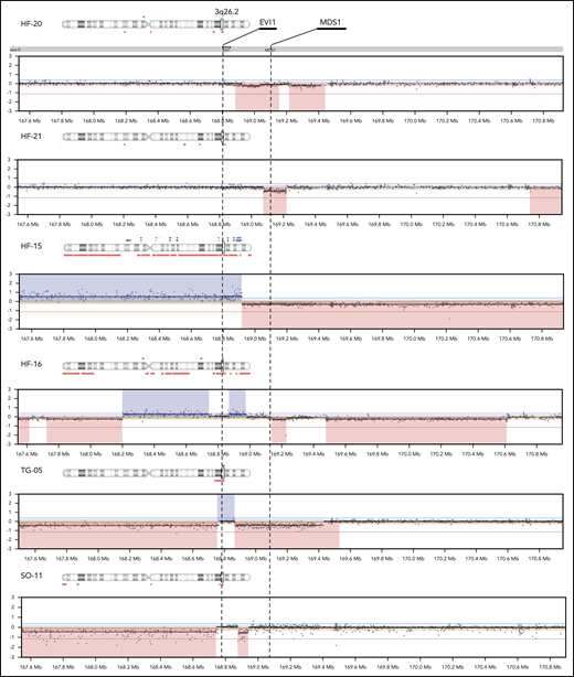Copy-number changes in the MECOM locus in atypical 3q26 AML. SNP array showing CNLs in red and CNGs in blue at chromosome band 3q26. EVI1 and MDS1-EVI1 are marked. Only the samples for which copy-number changes were found in this locus are illustrated (n = 6).
