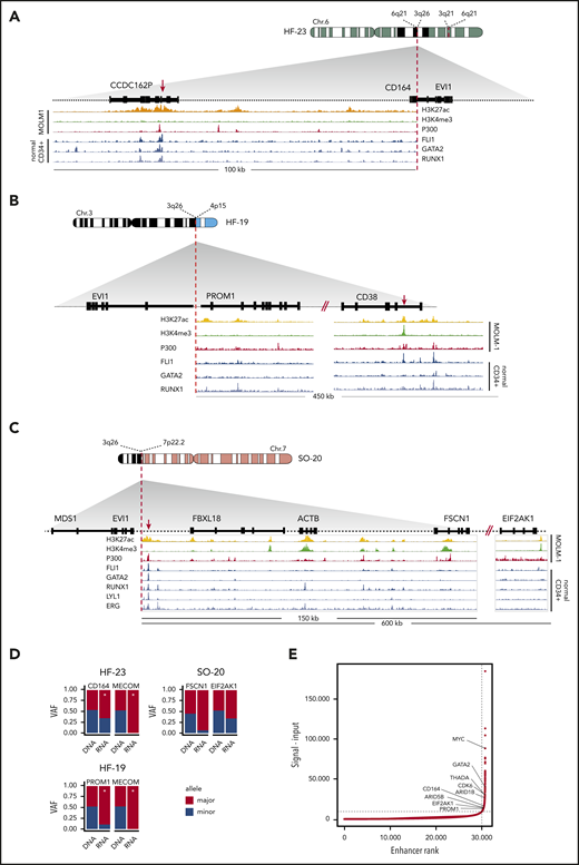 Rearrangements involving 3q26/EVI1 and newly identified partner loci. (A-C) Schematic depictions of chromosomal rearrangements of 3 unique atypical 3q26 patient samples: ins(6;3)(q26;q21q26) in patient #HF-23, t(3;4)(q26;p15) in patient #HF-19, and t(3;7)(q26;p22) in patient #SO-20. Figures show the loci and genes that have been rearranged and brought into the vicinity of MECOM: loci with CD164 and CCDC162P (6q21) in panel A, PROM1 and CD38 (4p15) in panel B, and FBXL18, ACTB, FSCN1 and EIF2AK1 (7p22) in panel C, respectively. ChIP-seq tracks indicative for active enhancer elements, ie, H3K27ac (yellow), H3K4me3 absence (green) and P300 (red), have been obtained from the MOLM-1 myeloid cell line.13 Previously published ChIP-seq tracks of myeloid transcription factors FLI1, GATA2, RUNX1, LYL1, and ERG using normal CD34+ cells are shown37 (blue). Enhancers possibly involved in EVI1 activation are indicated with a red arrow. (D) Bar plots showing skewed expression of genes that putatively donated their enhancer. The bar plots show the genes with skewed expression: CD164 (#HF-23), PROM1 (#HF-19), and FSCN1 and EIF2AK1 (#SO-20). In 2 out of 3 samples, monoallelic EVI1 expression was found (#HF-23 and #HF-19). Allele-specific EVI1 expression could not be determined in for #SO-20, since no SNPs could be detected. Asterisk (*) indicates significant differential expression between alleles (P < .05, χ2 test). (E) Hockey-stick plot showing the classification of these long stretches of H3K27ac (A-C) found in the partner loci as superenhancers (based on MOLM-1 H3K27ac ChIP-seq data using the ROSE algorithm).45