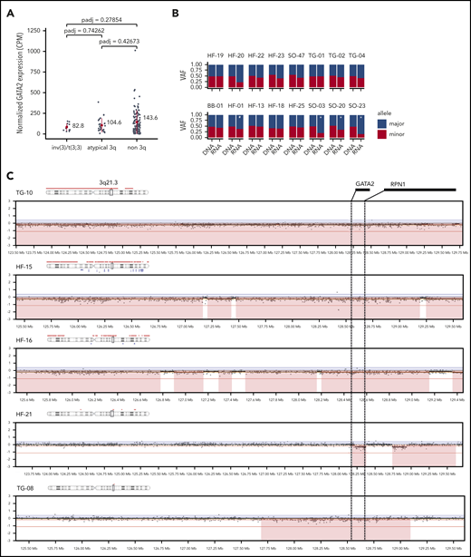 CNL of GATA2 or imbalanced GATA2 expression in atypical 3q26 AML. (A) GATA2 expression (CPM, RNA-seq) determined in inv(3)/t(3;3) (n = 11), in atypical 3q26 (n = 26) and non-3q26-rearranged AML (n = 111). Differences were not statistically significant (adjusted P < .05). Red dot represents the mean and the red bar the standard deviation. (B) Allele-specific analysis using DNA-seq and RNA-seq data showed significant skewed expression of GATA2 to 1 allele in 5 cases. In #HF-20, read depth was too low for a significance call. Asterisk (*) indicates significant differential expression between alleles (P < .05, χ2 test). (C) SNP-array data presented at chromosomal locus 3q21.3, showing CNLs in the GATA2 locus, resulting in loss (red) of the GATA2 gene or its enhancer (located between GATA2 and RPN1).