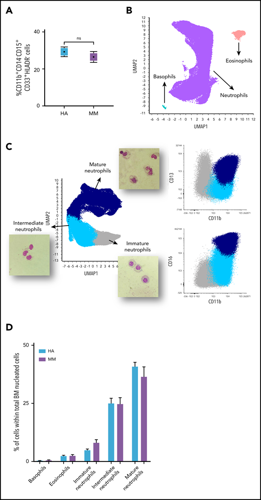 Characterization of G-MDSCs based on conventional criteria. (A) BM samples from MM patients (n = 10) and HAs (n = 7) were stained with HLADR-BV421, CD45-OC515, CD15-FITC, CD13-PE, CD33-PerCPCy5.5, CD16-PECy7, CD11b-APC, and CD14-APCH7 mAbs. Cells with a CD11b+CD14−CD15+CD33+HLADR− phenotype represent ∼25% of total BM nucleated cells both in HAs and MM patients. (B) Unbiased analysis based on uniform manifold approximation and projection (UMAP) according to expression levels of HLADR, CD45, CD15, CD13, CD33, CD16, CD11b, and CD14 revealed various granulocytic subsets (neutrophils, eosinophils, and basophils) in BM samples from HAs and MM patients. (C) UMAP of the neutrophil population led to the identification of 3 neutrophil maturation stages according to differential expression of CD11b, CD13, and CD16: immature (CD11b−CD13−/loCD16−), intermediate (CD11b+CD13−/loCD16−), and mature (CD11b+CD13+CD16+) neutrophils. Cellular maturation was confirmed on cytospinned cells from the 3 different populations by evidencing the classic changes in nuclear shape. Images are shown with a ×400 magnification. (D) Frequency of each granulocytic subset was similar between HAs and MM patients. Bars represent the mean and lines the standard deviation.