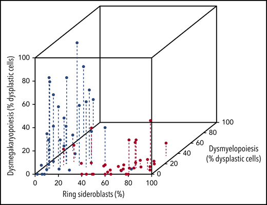 Tridimensional scatterplot of SF3B1-mutated and unmutated MDS with RS according to bone marrow dysplastic features. Red dots identify MDS associated with SF3B1 mutation, whereas blue dots identify MDS unmutated for SF3B1. The degree of dysmyelopoiesis and dysmegakaryopoiesis is measured as percentage of lineage dysplastic cells.14