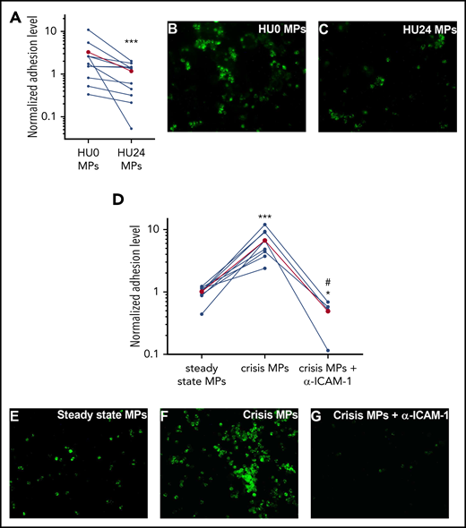 SCD neutrophil adhesion is decreased by HU24 MPs but potentiated by crisis MPs. After a 4-hour incubation of ECs with MPs, fluorescently labeled SCD neutrophils (green) had a significantly decreased adhesion level using HU24 MPs vs HU0 MPs (A), whereas crisis MPs increased the adhesion level compared with steady-state MPs from the same SS patients (n = 11 and 9 per cohort, respectively) (D). Combination of crisis MPs and blocking anti–ICAM-1 antibody (α–ICAM-1) led to a stark decrease in adhesion level compared with crisis MPs or steady-state MPs. Levels in the HU0 MPs or the steady-state MPs were used for normalization. The mean level for each group is shown in red. Representative photomicrographs of each condition are shown: HU0 MPs (B) or HU24 MPs (C) for the same SS patients or with steady-state MPs (E), crisis MPs (F), or crisis MPs from the same SS patients but in combination with a blocking anti–ICAM-1 antibody (G) (original magnification ×400). Nuclei of ECs and of neutrophils were labeled using DAPI (data not shown). #P < .05 vs crisis MPs, *P < .05, ***P < .001 vs HU0 MPs or steady-state MPs.