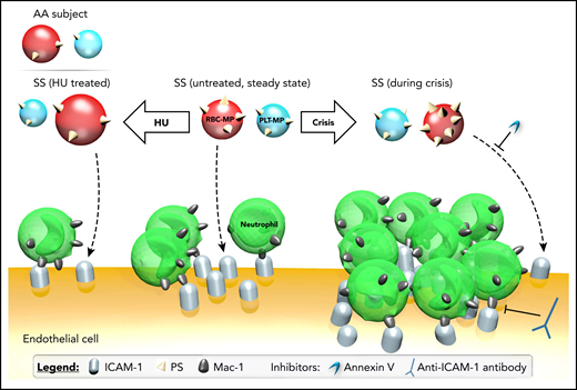 Impact of MPs on the proadhesive phenotype of ECs. PS exposure by plasma PLT-MPs and RBC-MPs, which may facilitate the binding of SS MPs to ECs, is increased during crisis but decreased after treatment with HU for 2 years. These changes in MP quality explain, at least in part, why MPs of HU-treated SS patients decreased ICAM-1 expression levels, whereas crisis MPs increased the expression of this adhesion protein. Neutrophil adhesion was consistently decreased using plasma MPs from HU-treated SS patients, whereas crisis MPs triggered increased adhesion. ICAM-1 overexpression and increased adhesion of neutrophils with crisis MPs were abolished by AV and ICAM-1 blocking, respectively. AA MPs cause a decrease in ICAM-1 at the mRNA and protein levels in ECs, as well as neutrophil adhesion, compared with MPs from untreated SS patients.