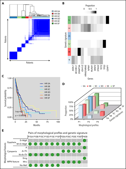 Genetic signatures in HR MDS. (A) Consensus clustering applied to genetic mutations identify a signature with 6 subtypes (HR-SA through HR-SF) among HR patients in the discovery cohort. (B) Distribution of mutations within each genetic signature. Frequently mutate genes (in ≥5% of patients) are shown. (C) Kaplan-Meier curves compare overall survival among patients identified by 6 genetic subtypes; the P value is from the log-rank test. (D) Distribution of morphologic profiles in each genetic signature. Frequent profiles (in >15% of patients) in each genetic signature are depicted. (E) The presence of specific morphologic features across morphologic profiles and genetic signatures. Representative morphologic features are shown in rows; frequent pairs of morphologic profiles and genetic signature are displayed as columns.