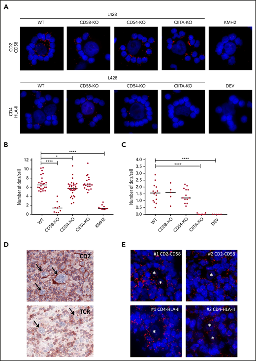 Proximity ligation assay shows the proximity of CD2-CD58 and CD4-HLA-II in vitro and in HL tissue. (A) Results of PLAs of L428 WT, CD58-KO, CD54-KO, CIITA-KO, the CD58− KMH2 or the HLA-II− DEV cell line cocultured with matched PBMCs for CD2-CD58 and CD4-HLA-II (red signal). Nuclei were counterstained with 4′,6-diamidino-2-phenylindole (DAPI; blue signal). Quantification of the number of red dots at the tumor cell–T-cell interface of CD2-CD58 (B) and CD4-HLA-II (C) for multiple rosettes using 1 HLA-II–matched donor. Each point in the graph indicates the average number of red dots per attached cell in a single rosette. (D) Immunohistochemical staining for CD2 and TCR in snap-frozen primary HL tissue. Arrows indicate tumor cells. (E) PLA staining (red signal) for CD2-CD58 and CD4-HLA-II on 2 different tissue samples from patients with primary HL. Nuclei were counterstained with DAPI (blue signal). Asterisks indicate tumor cells. In panels A and E, PLA signals were visualized with a Leica DM4000B microscope equipped with a Leica DFC345FX Camera and LAS V4.8 software. All images are representative; original magnification ×400. Red dots indicate the proximity (within 40 nm) of the 2 proteins studied. Statistical significance was calculated with a 1-tailed Mann-Whitney U test, with all conditions compared with the WT. *P < .05; ****P < .0001.