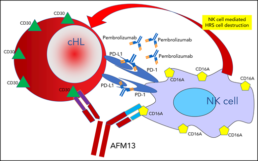 One arm of the bispecific antibody AFM13 binds to CD30 surface antigens on cHL HRS cells, and the other arm binds to CD16A surface antigens on NK cells, leading to NK cell–mediated destruction of the HRS cells. This therapeutic attack is dramatically enhanced by adding pembrolizumab, which blocks the protection from immune attack that HRS cells employ by elaborating PD-L1.