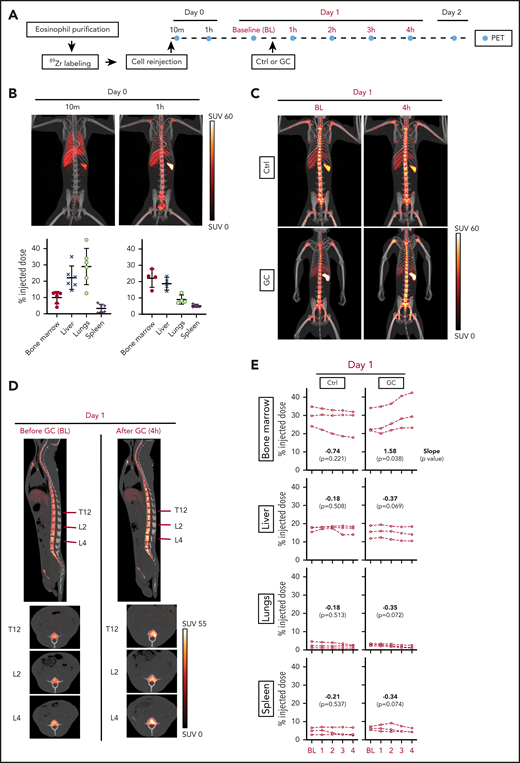 Glucocorticoids induce bone marrow migration of eosinophils. Circulating rhesus eosinophils were purified, labeled with 89Zr-oxine, and reinjected. PET/CT imaging was performed to track the location of the cells over time, with or without glucocorticoid administration. (A) Experimental design. Day 0 corresponds to the day of cell reinjection. Imaging on day 0 was performed immediately after reinjection (indicated by the 10-minute time point, which corresponds to the midpoint of the 20-minute imaging session), and 1 hour after reinjection. On day 1, animals in the treatment arm each received a single intravenous dose of glucocorticoid (GC, methylprednisolone 4 mg/kg), administered 30 minutes after BL PET imaging. Subsequent images were acquired hourly (counting from the time of BL imaging) for 4 hours. Control (Ctrl) animals were imaged serially at the same time points, without GC administration. Three independent experiments were performed per group, each on a different day in an unrelated adult rhesus macaque. The abbreviations and colors for each time point are preserved in the other panels of the figure to facilitate interpretation. (B) Live tracking of 89Zr-oxine–labeled eosinophils in the first hour after cell reinjection on day 0. Representative MIP PET/CT images at 10 minutes and 1 hour on day 0 are shown (top, SUV: standardized uptake value). The quantification of 89Zr distribution expressed as % ID with decay correction, is plotted for each organ at each imaging time point (bottom). These values indicate the percentage of the total 89Zr activity in a given organ’s volume, relative to the injected dose. (C) Live tracking of 89Zr-oxine labeled eosinophils in the absence (top) or presence (bottom) of glucocorticoid administration on day 1. Representative MIP PET/CT images at BL and 4 hours. (D) Sagittal and axial images of the spine in glucocorticoid-treated animals, before (BL) and after (4 hours) glucocorticoid injection. The red lines indicate the locations of the axial slice planes shown at the bottom. PET/CT images of 1 representative animal are shown. (E) Localization of 89Zr-oxine labeled eosinophils over time, with or without glucocorticoid administration. The x-axis is the time (in hours) after BL imaging. The y-axis displays 89Zr-oxine labeled eosinophil distribution, expressed as a decay-corrected percentage of the injected dose. Data are displayed separately for each of 4 organs: bone marrow, liver, lung, or spleen. Linear regression was performed separately for the 3 animals in the glucocorticoid arm and the 3 animals in the control arm. In both regressions, the response is organ 89Zr distribution (from the 89Zr-oxine labeled-eosinophils) expressed as a percentage of the injected dose; the regressors are the type of organ, the observation time point, and their interaction. The slope, or rate of change in each organ, is shown along with the P value from a Wald test indicative of whether the slope is significantly different from 0.