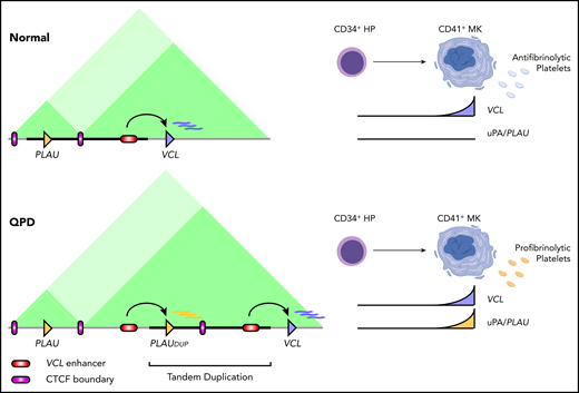 Model of enhancer adoption in QPD. Regulatory interactions at the PLAU locus in megakaryocytes for control (top) vs the QPD (bottom) chromosome. Dark green rectangles mark sub-TADPLAU and sub-TADVCL. Bold black line marks the QPD duplication. HP, hematopoietic progenitor; MK, megakaryocyte.