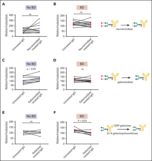 Enzymatic modifications of immunoglobulins alter pro-osteoclastogenic properties. IgG from individual patients with and without BD (n = 7-11 in each group) were treated with neuraminidase (A-B) and galactosidase (C-D) to reduce sialylation and galactosylation, respectively, and then added to preosteoclasts for 2 to 4 days before the number of TRAP-positive cells with ≥3 nuclei was counted. (E-F) IgG from patients with and without BD were treated with UDP-galactose to increase galactosylation and added to preosteoclasts for 2 to 4 days before the number of TRAP-positive cells with ≥3 nuclei was counted. The number of mature osteoclasts was evaluated by using TRAP stain. Data presented in panels A-F are relative to RANKL control. P values determined by Wilcoxon matched-pairs signed rank test. Symbols: purple diamond, sialic acid; yellow circle, galactose; blue square, GlcNAc; green circle, mannose; red triangle, fucose. ns, not significant.